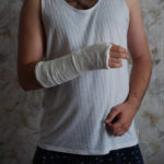 man wearing a cast on his arm