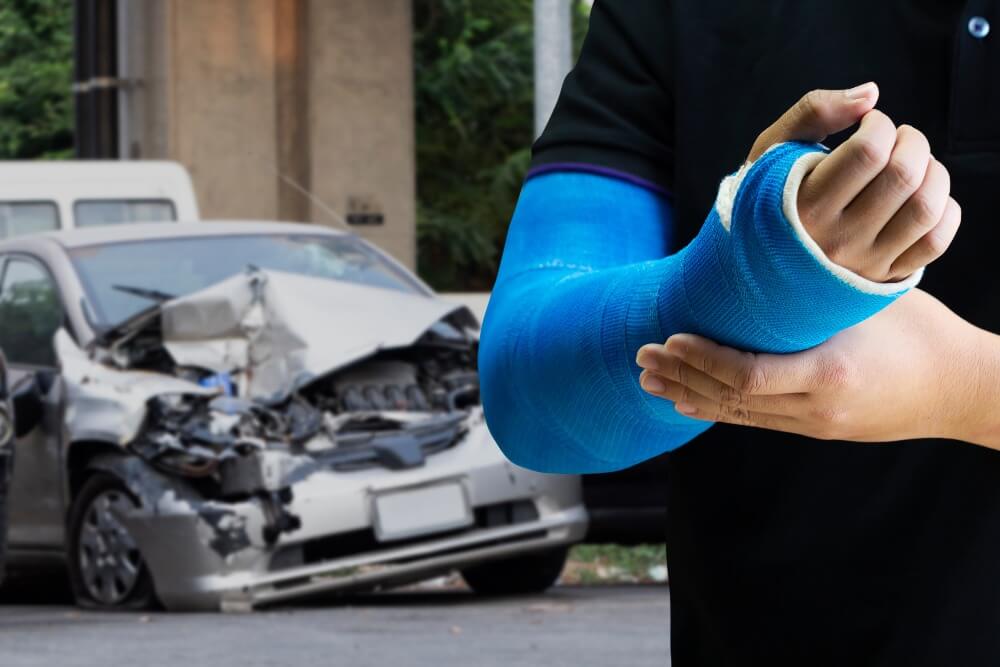 man wearing an arm cast